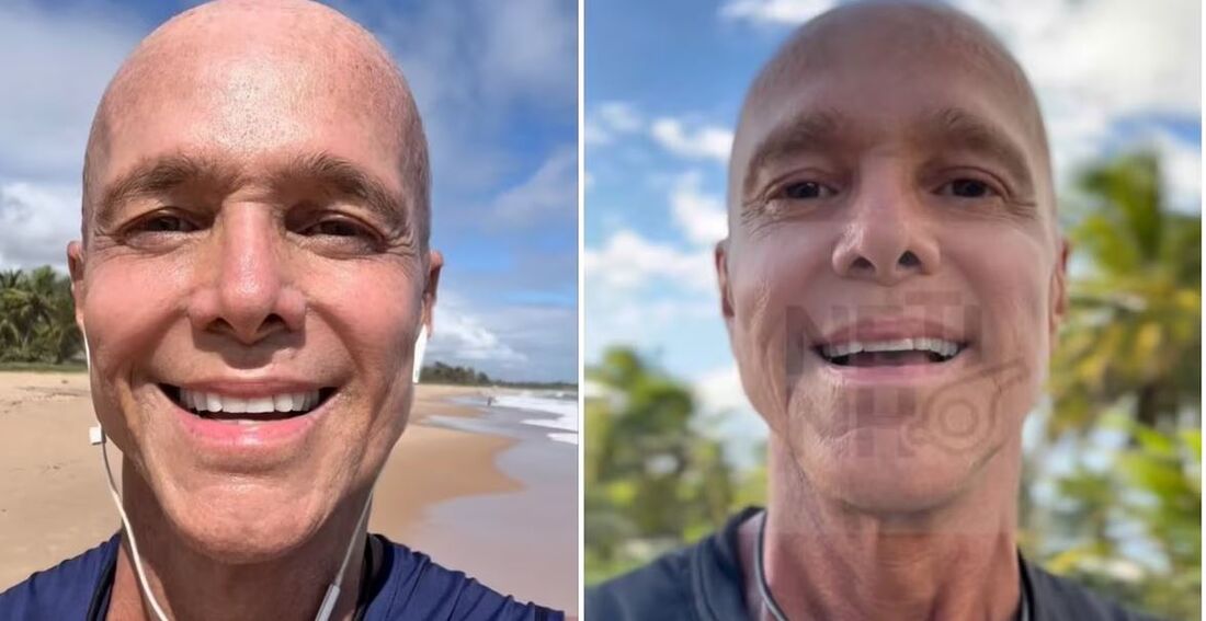 Aos 58 anos, Netinho foi diagnosticado com um linfoma raro, que afeta o sistema linfático