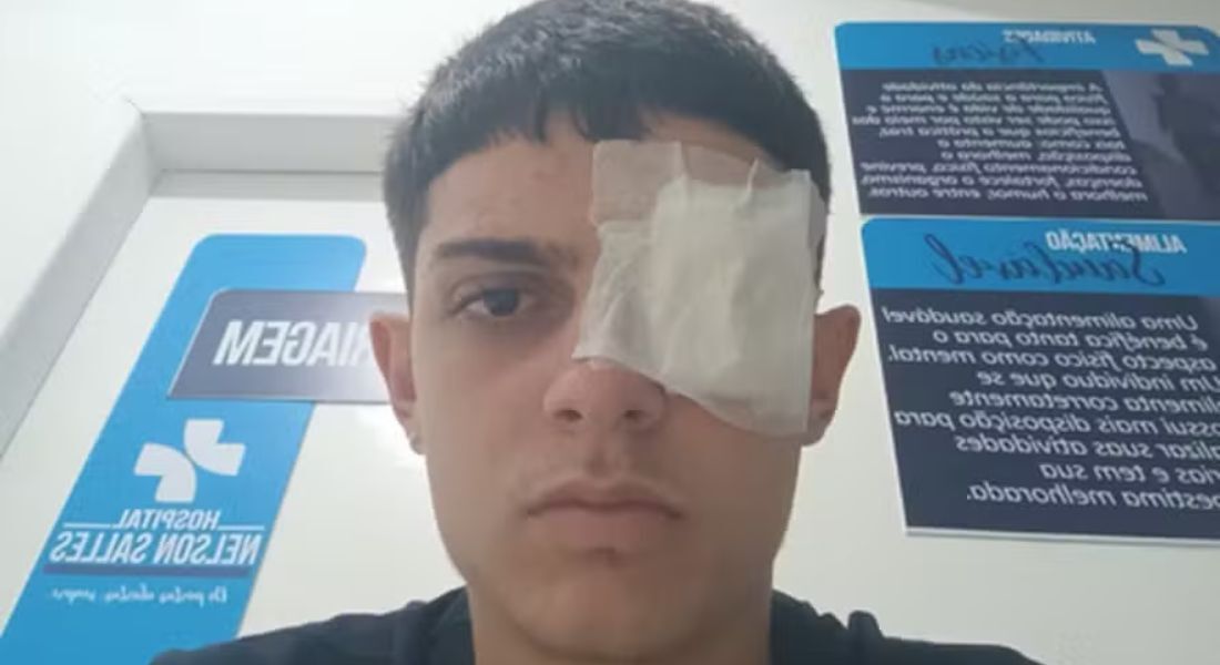 Jovem atleta ferido por rojão relata drama em vestiário na Copa Rio Sul de Futsal