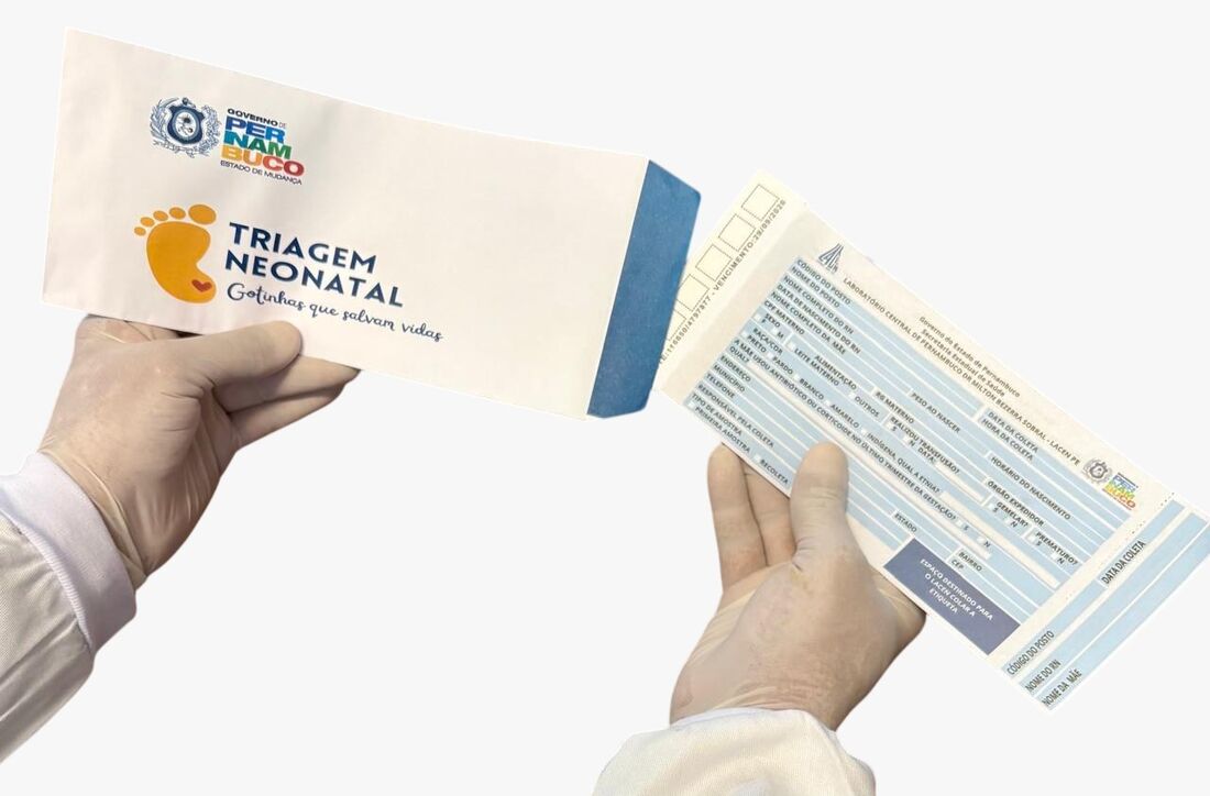 Galactosemia impede o bebê de ingerir o açúcar do leite corretamente