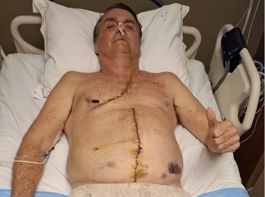 O ex-presidente Jair Bolsonaro na UTI