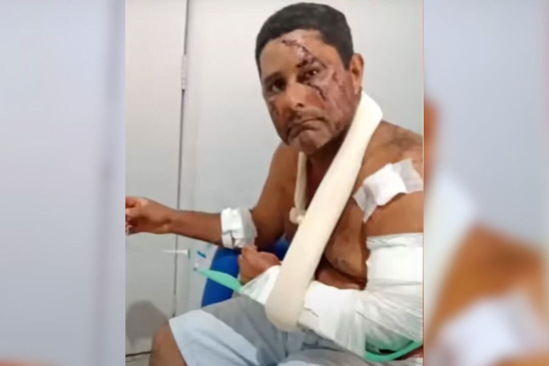 O homem conseguiu se defender usando um facão, mas sofreu muitos ferimentos. Foto: Portal do Valle Jornalismo Via Youtube