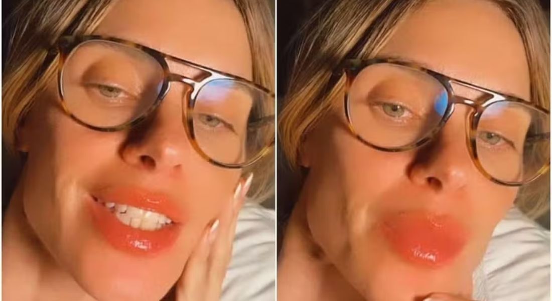 Carolina Dieckmann: entenda por que atriz ficou com lábios inchados após viagem de avião