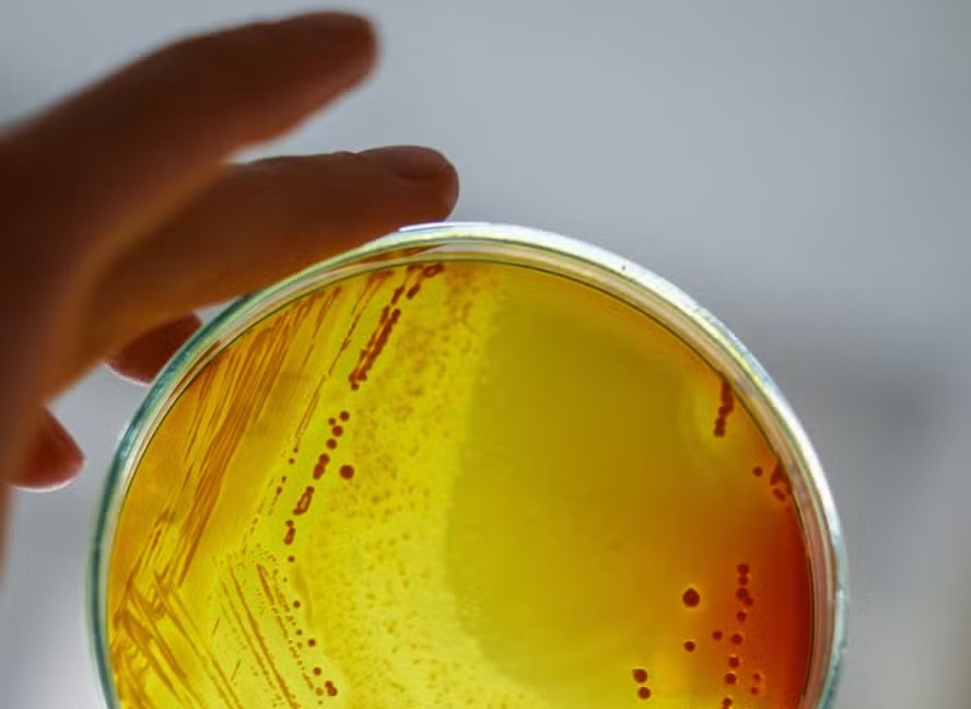 Cultura de laboratório da bactéria Staphylococcus aureus