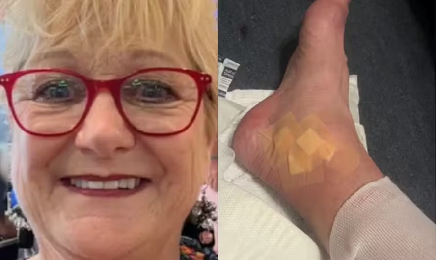 Inglesa contrai infecção grave após pequeno corte com taça de vinho em casa e aconselha: 'Ajam imediatamente' 