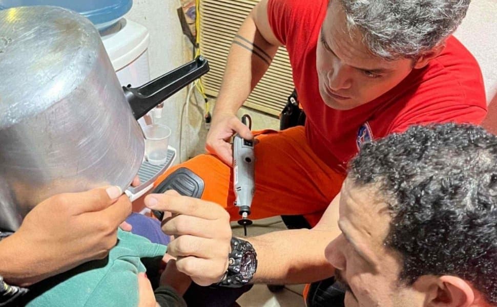 Para a retirada da panela de pressão com segurança, os bombeiros protegeram o rosto da criança com compressa cirúrgica.