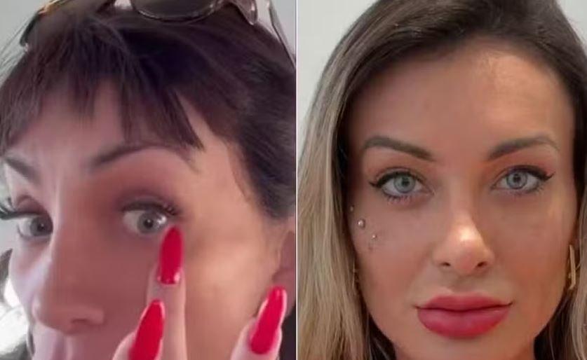 Maya Massafera e Andressa Urach após procedimento de mudança da cor de olhos 