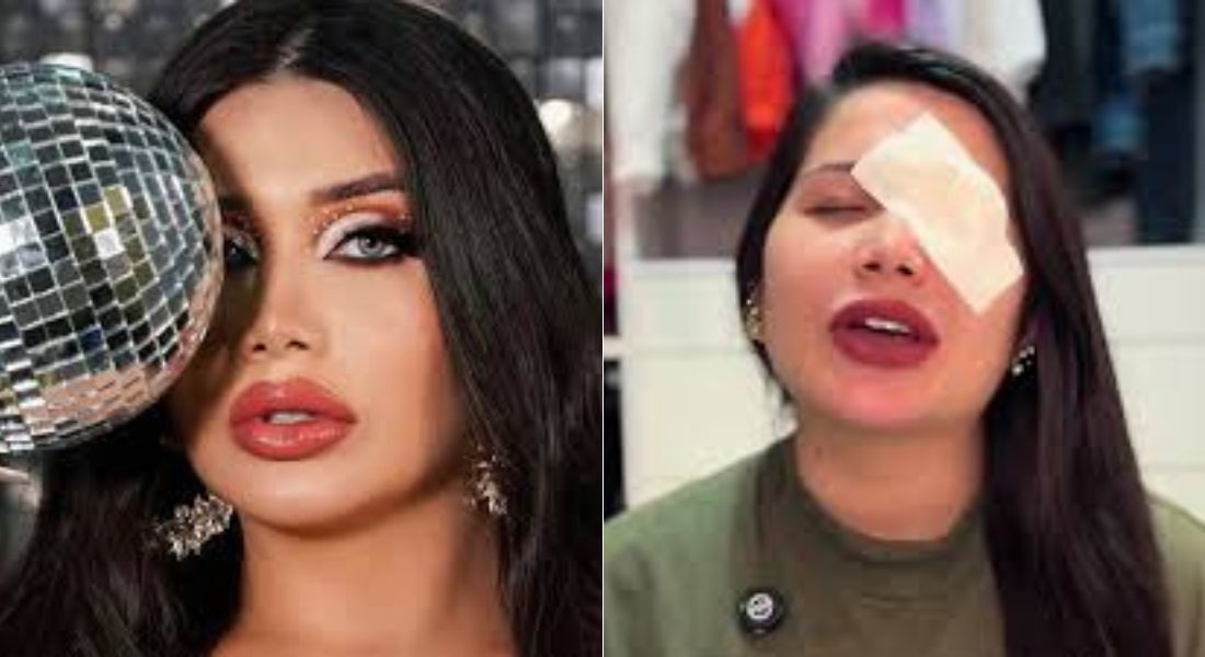 Luma Couttinho sofreu hemorragia ocular por usar lente de contato vencido