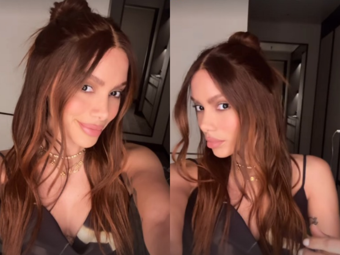 Anitta reaparece após novos procedimentos estéticos 