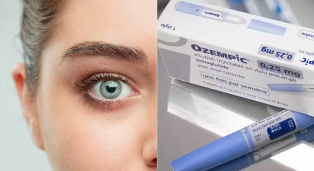 Estudos dinamarqueses mostram risco dobrado de problemas oculares em pacientes com diabetes tipo 2 que usam Ozempic