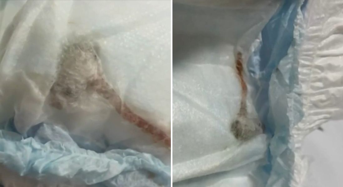 Mãe encontra rato morto dentro de fralda do filho; Delegacia do Consumidor do Rio investiga