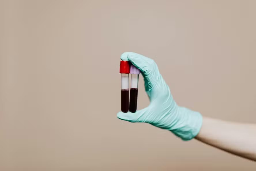Sangue oferece informações sobre como seu DNA está sofrendo a influência ambiental 