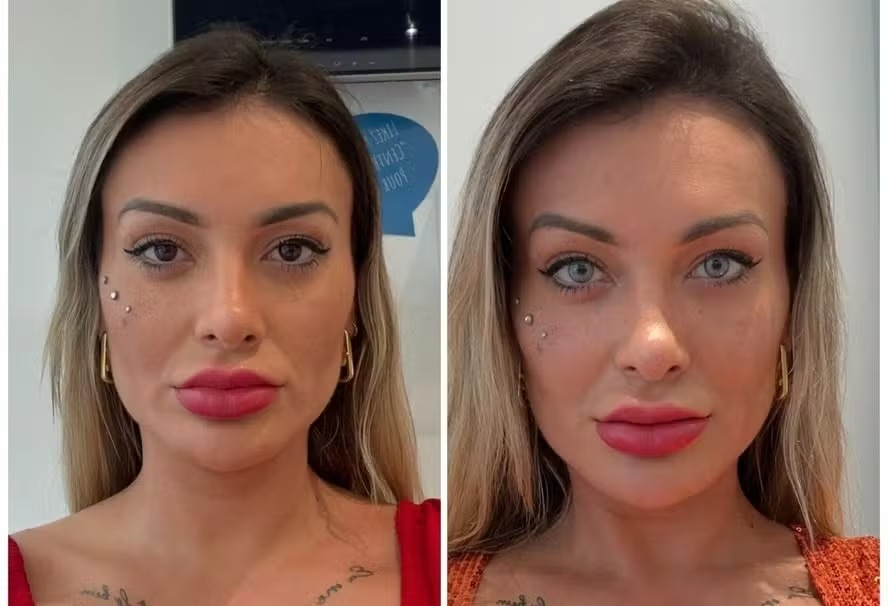 Andressa Urach antes e após mudança da cor dos olhos 