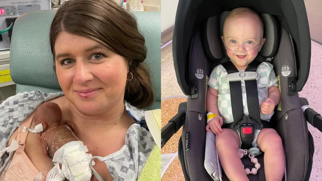 Nascido com apenas 280 gramas, de uma gestação de 21 semanas, Nash Keen celebrou este mês seu primeiro aniversário