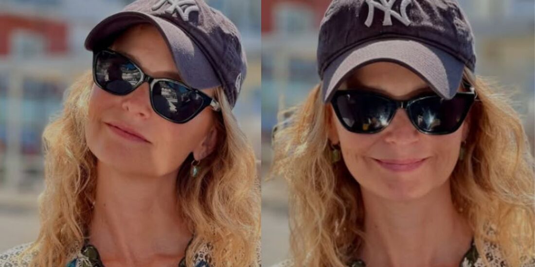 Fernanda Rodrigues fará um novo procedimento após o retorno de um carcinoma basocelular