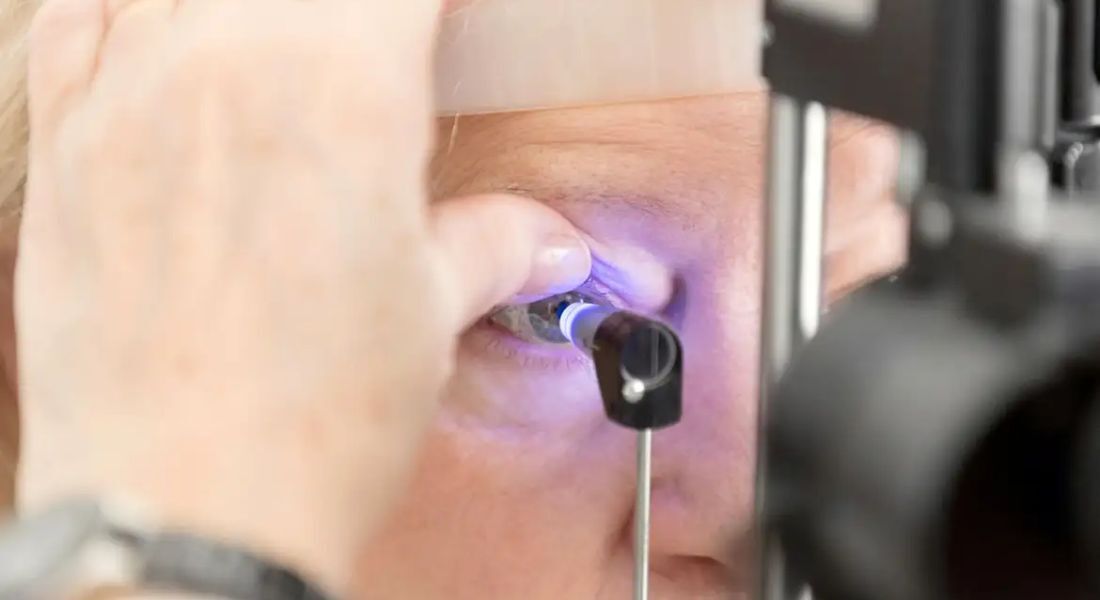 A proposta é normatizar procedimentos cirúrgicos relacionados à triquíase tracomatosa