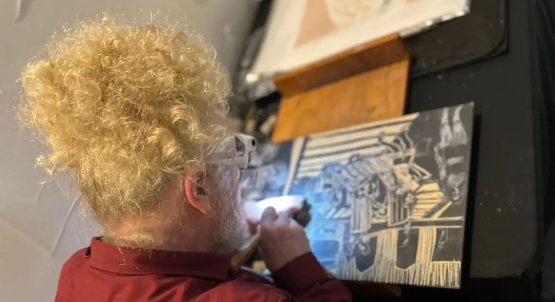 O artista plástico Daniel Freitas prioriza o amarelo, simbolizando sua condição de fotobia