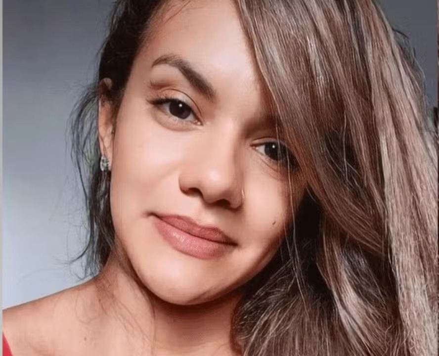 Juliana Garcia passará por cirurgia de reconstrução 