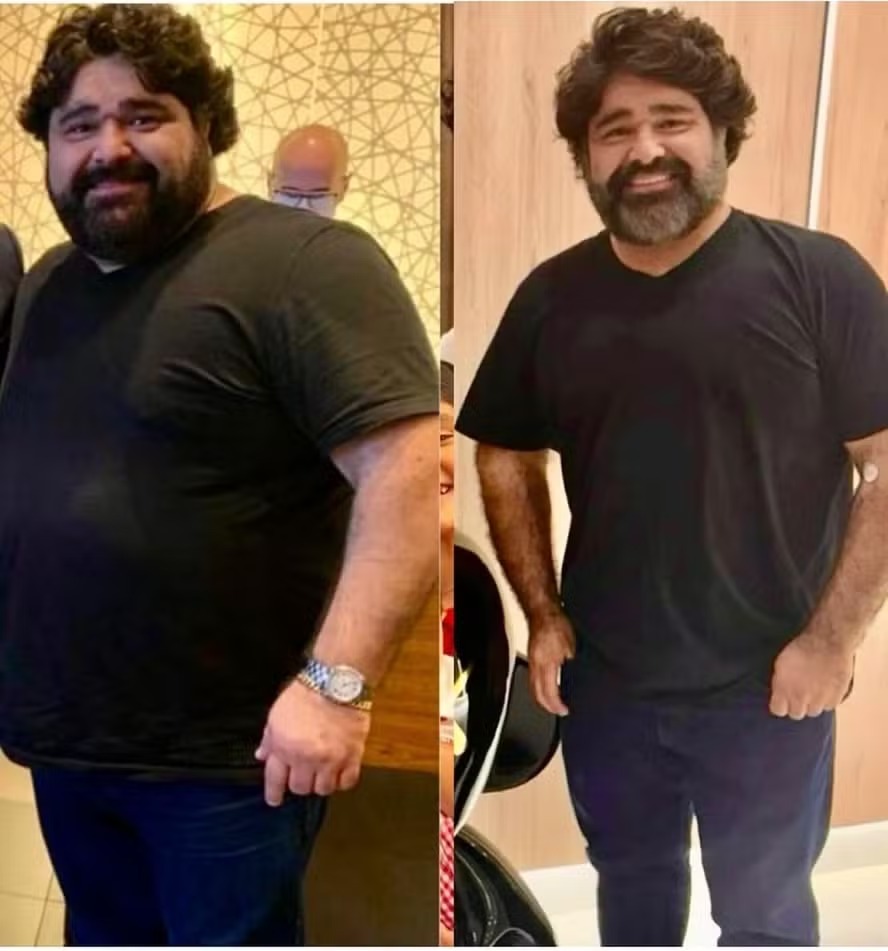 Antes e depois do cantor 