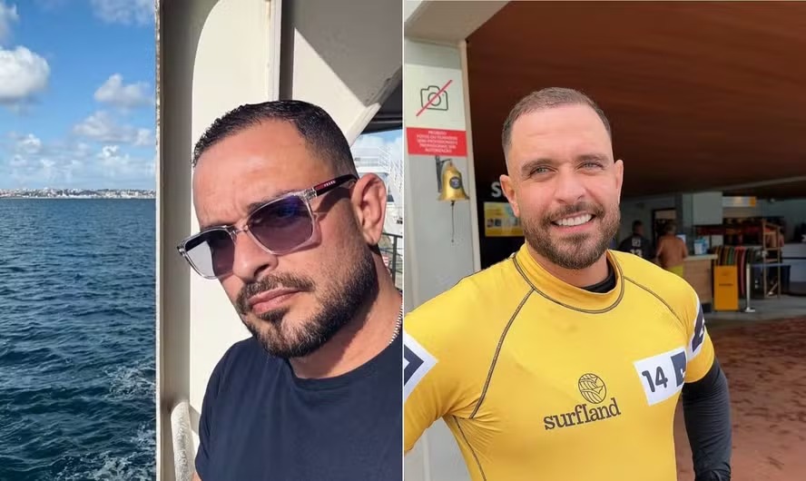 Diogo Nogueira aparece irreconhecível em suas redes sociais após resultados de transplante capilar aparecerem 