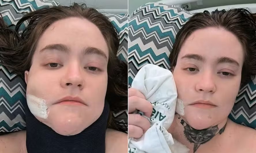 Carolina Arruda, de 27 anos, sofre com 'a pior dor do mundo' Foto: