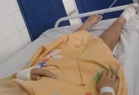 Criança tem dedo do pé amputado após sofrer acidente em brinquedo da Praça da Infância