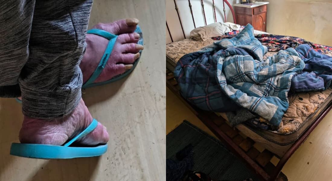 Atriz estava em condições sub-humanas e com sinais de demência quando foi encontrada