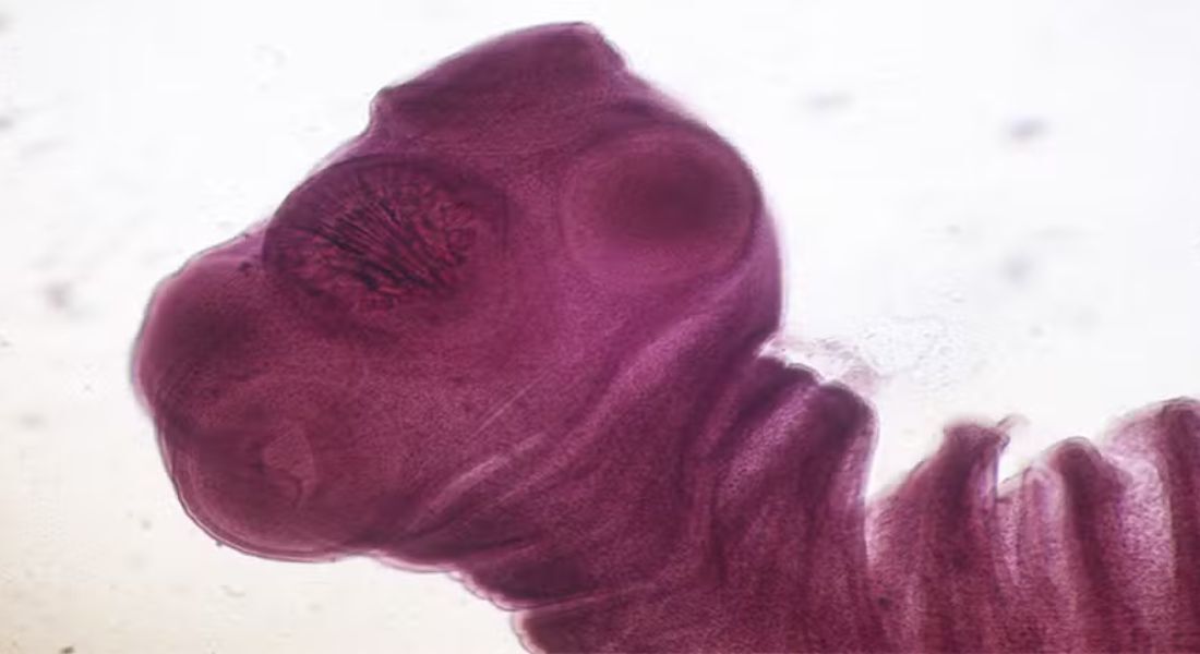 Taenia solium, conhecida como "tênia" ou "solitária" do porco, é o parasita responsável pela neurocisticercose.  Foto: 