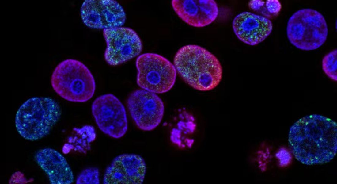 Células de câncer colorretal