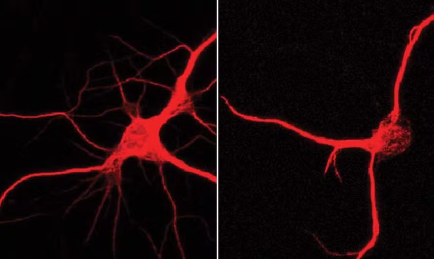 Os cientistas observaram como os genes e proteínas do hipocampo mudaram ao longo do tempo em camundongos 