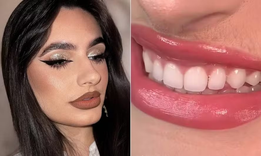 A influenciadora Tainara Reis é uma das brasileiras que deixa o buço crescer