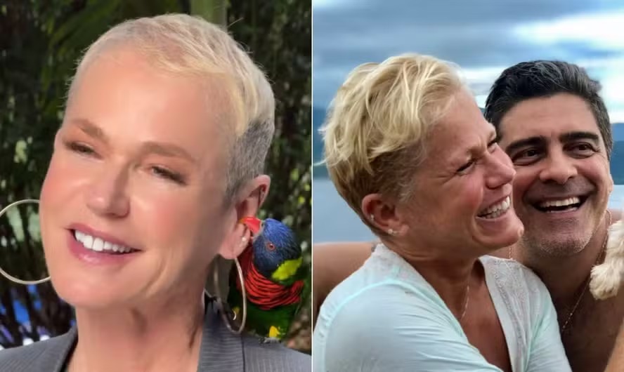 Antes e depois do transplante capilar de Xuxa