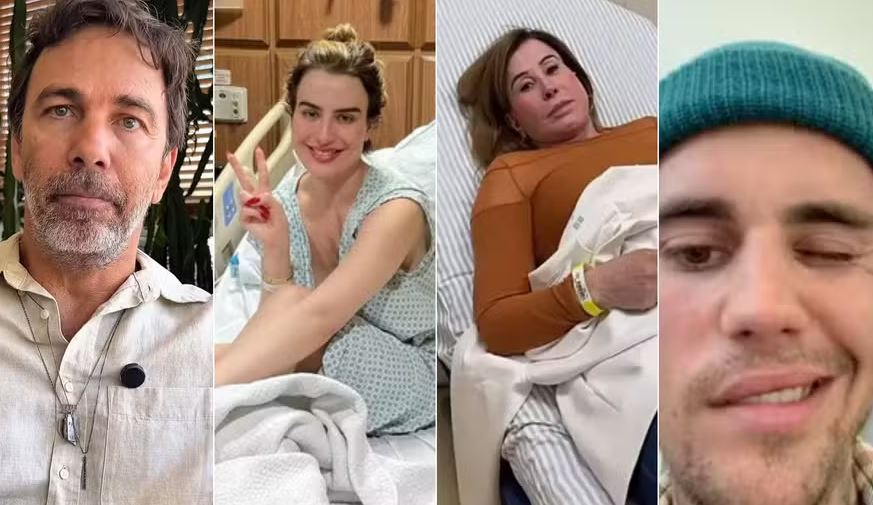 Além de Marcelo Faria, outros famosos, como Fernanda Keulla, Zilu Godoi e Justin Bieber, também sofreram com a herpes-zóster