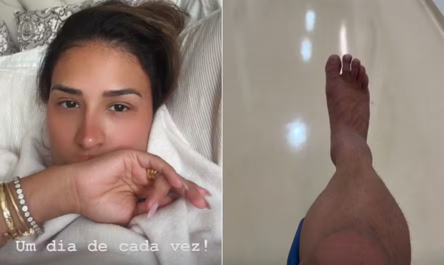Simone Mendes e o marido, Kaká Diniz, foram todos hospitalizados nos últimos dias 