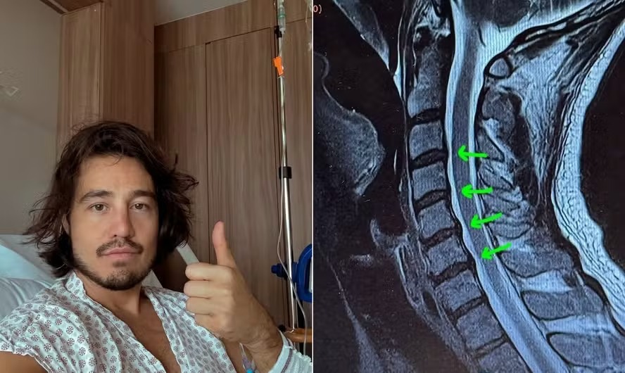 Tiago Iorc foi internado às pressas por crise de hérnia de disco