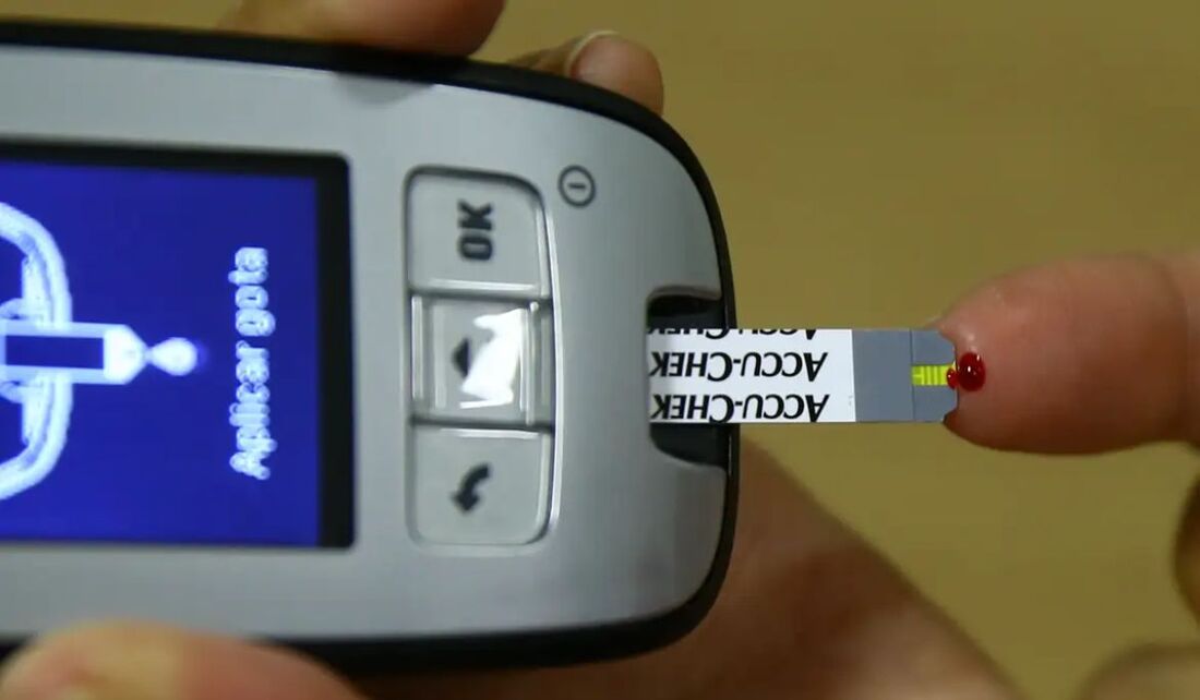 Exame da curva glicêmica e utilização de monitor de glicemia