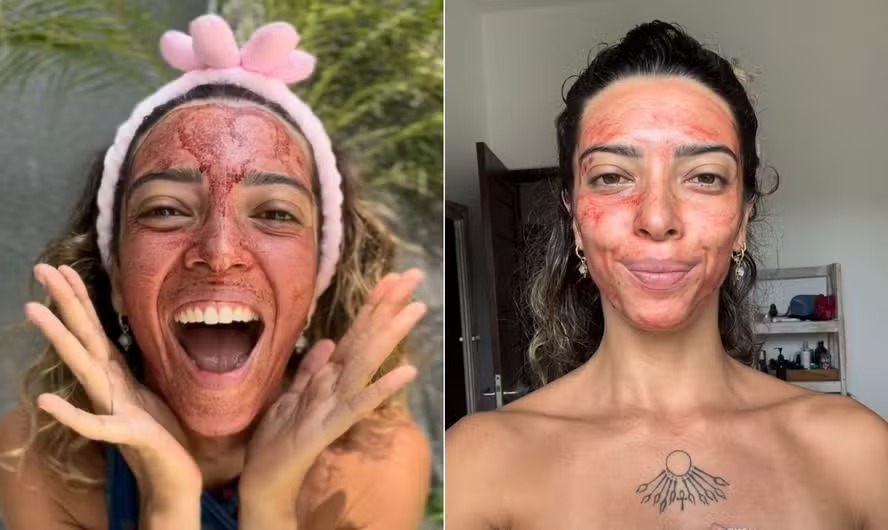 Sarah Sol, de 32 anos, utiliza sangue menstrual como máscara facial