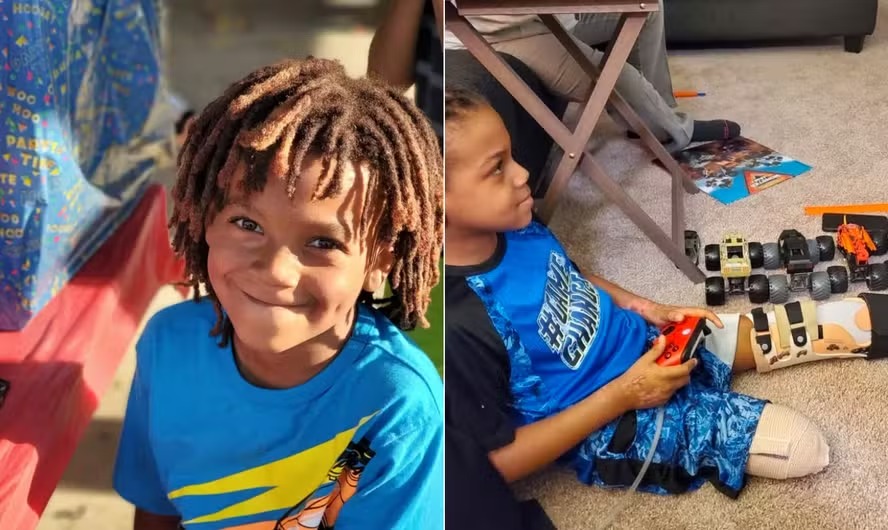 Kaden Stevenson perdeu as duas pernas devido a complicações da gripe 