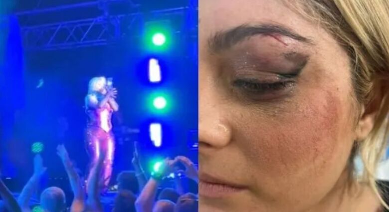 Bebe Rehxa foi atingida por um celular (Foto: Reprodução)