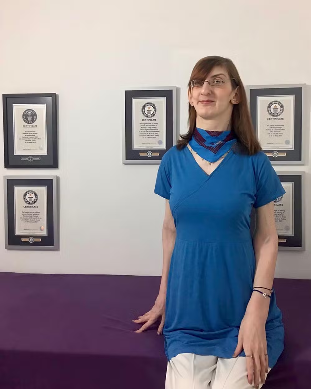 Rumeysa Gelgi, a mulher mais alta do mundo, tem 27 anos | Foto: Redes Sociais/Reprodução