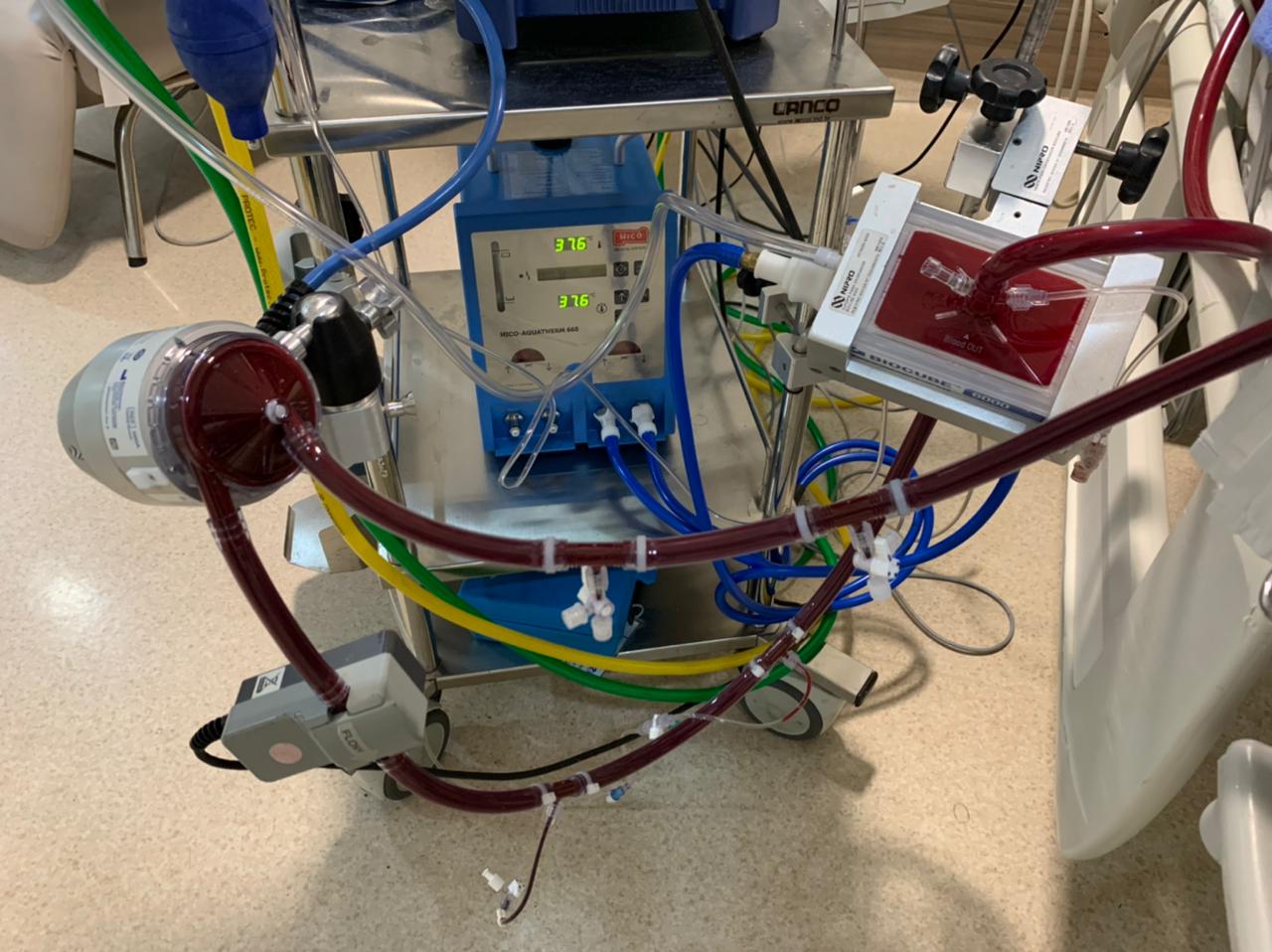 Equipamento para terapia de oxigenação por membrana extracorpórea (ECMO), no Real Hospital Português, no Recife