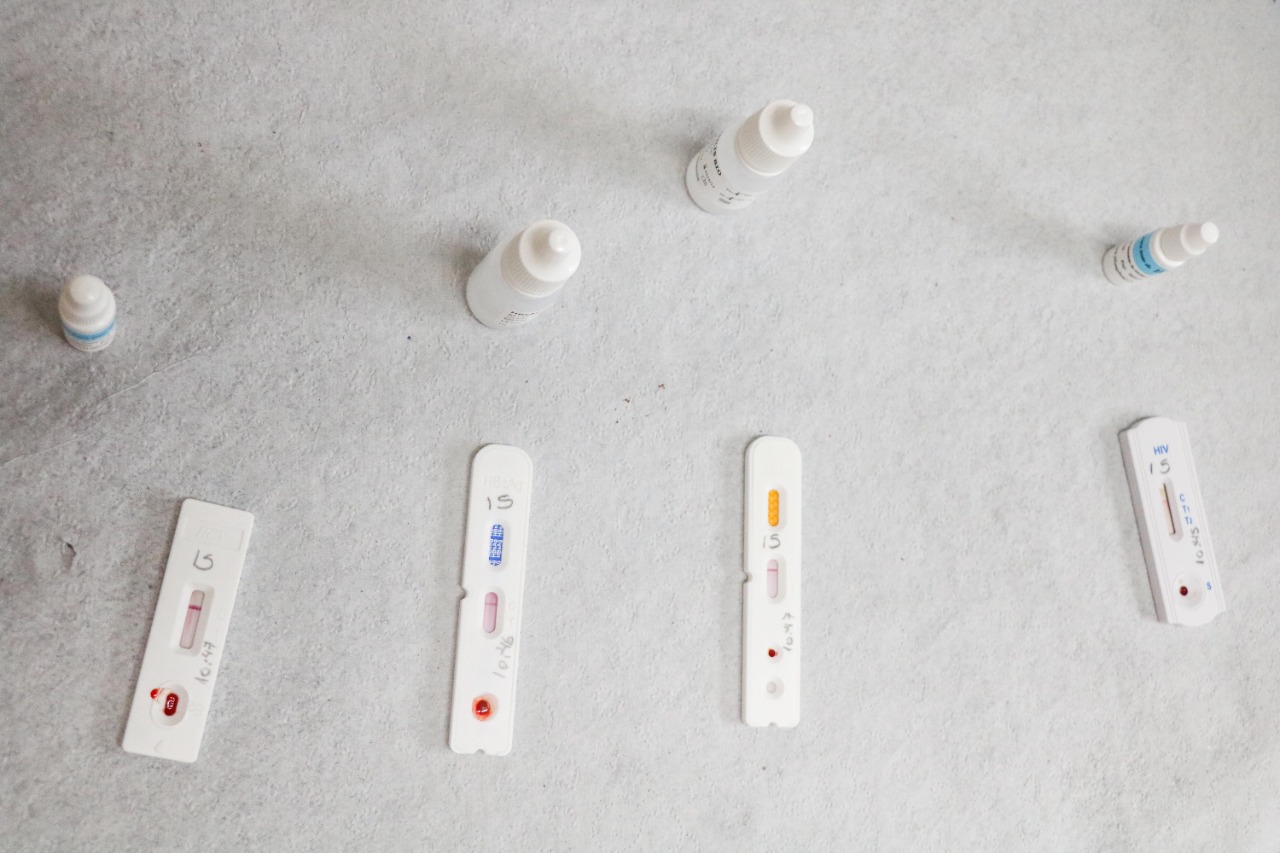 Em comparação com 2020, houve um salto de 24% no número de registros de casos de HIV em pacientes do sexo masculino