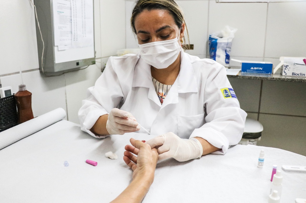 Em comparação com 2020, houve um salto de 24% no número de registros de casos de HIV em pacientes do sexo masculino