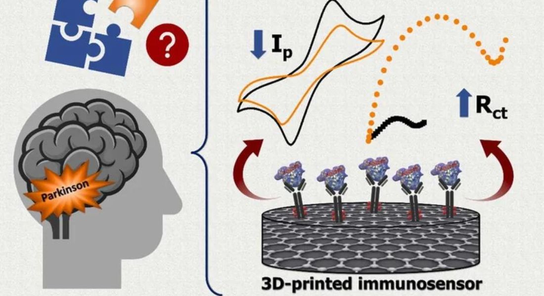 Cientistas brasileiros desenvolvem sensor barato que identifica doença de Parkinson em estágio inicial