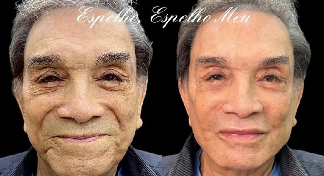 Confira o antes e depois de algumas celebridades, Famosos