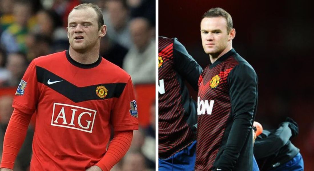 Wayne Rooney fez o procedimento enquanto ainda era jogador