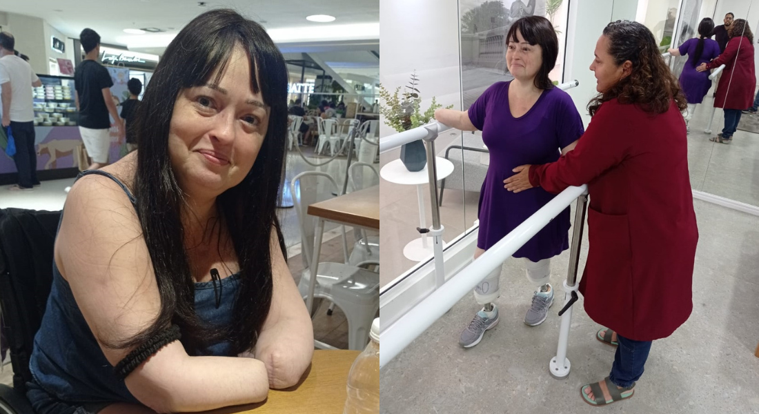 Kátia teve uma vasculite - inflamação nos vasos sanguíneos - e perdeu mãos e pernas