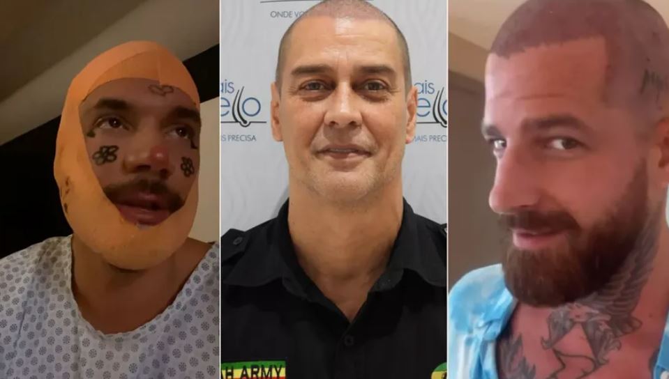 Além de Eli, Marcello Antony e Leandro D'Lucca se submeteram ao transplante capilar 