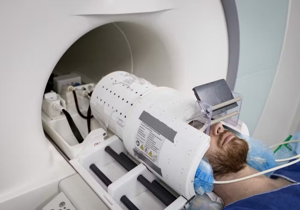 Voluntário tem cérebro examinado na máquina Iseult Magneton 11.7 T MRI, na França