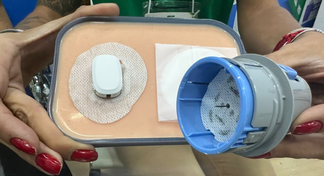 Smart é um monitor de glicemia - Foto: Isabelle Barbosa/Folha de Pernambuco