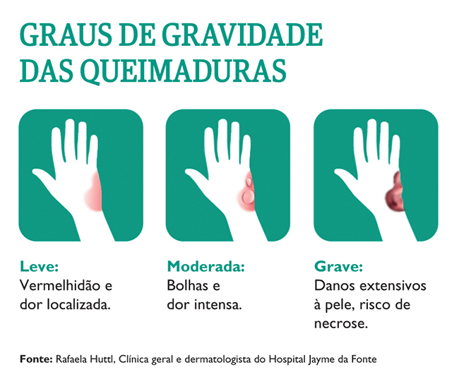 Veja graus de gravidade das queimaduras